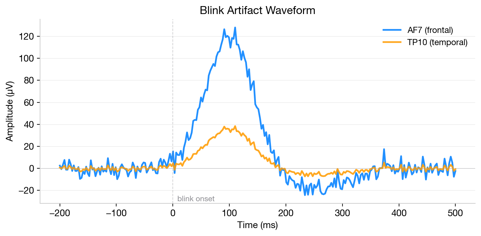 Blink artifact waveform